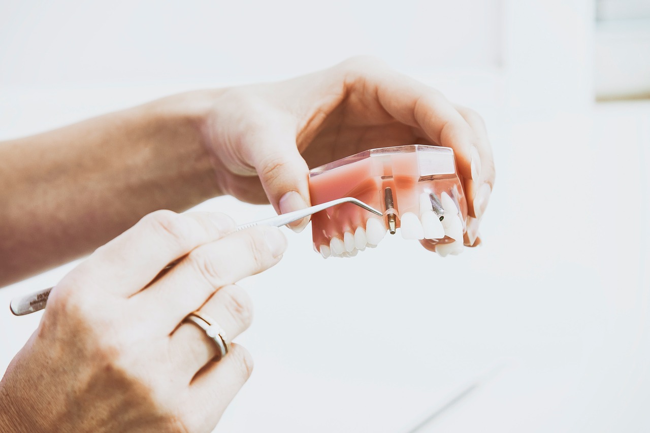 Prothèse dentaire provisoire en résine