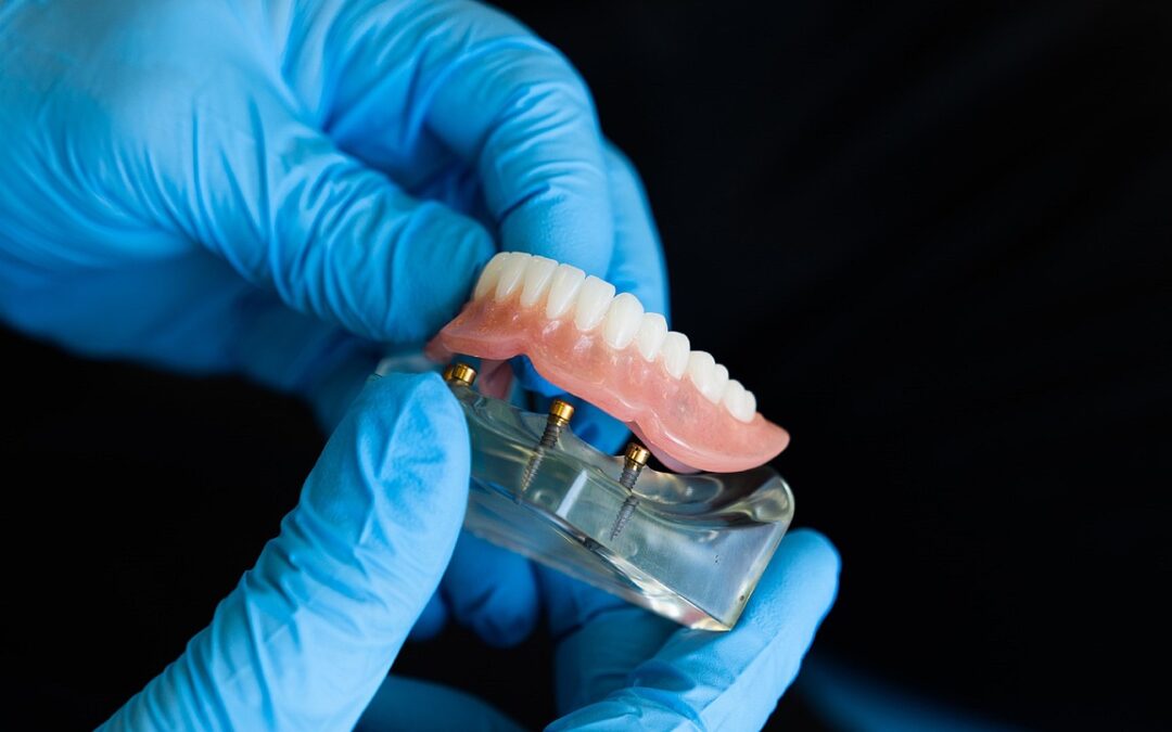 appareil dentaire provisoire