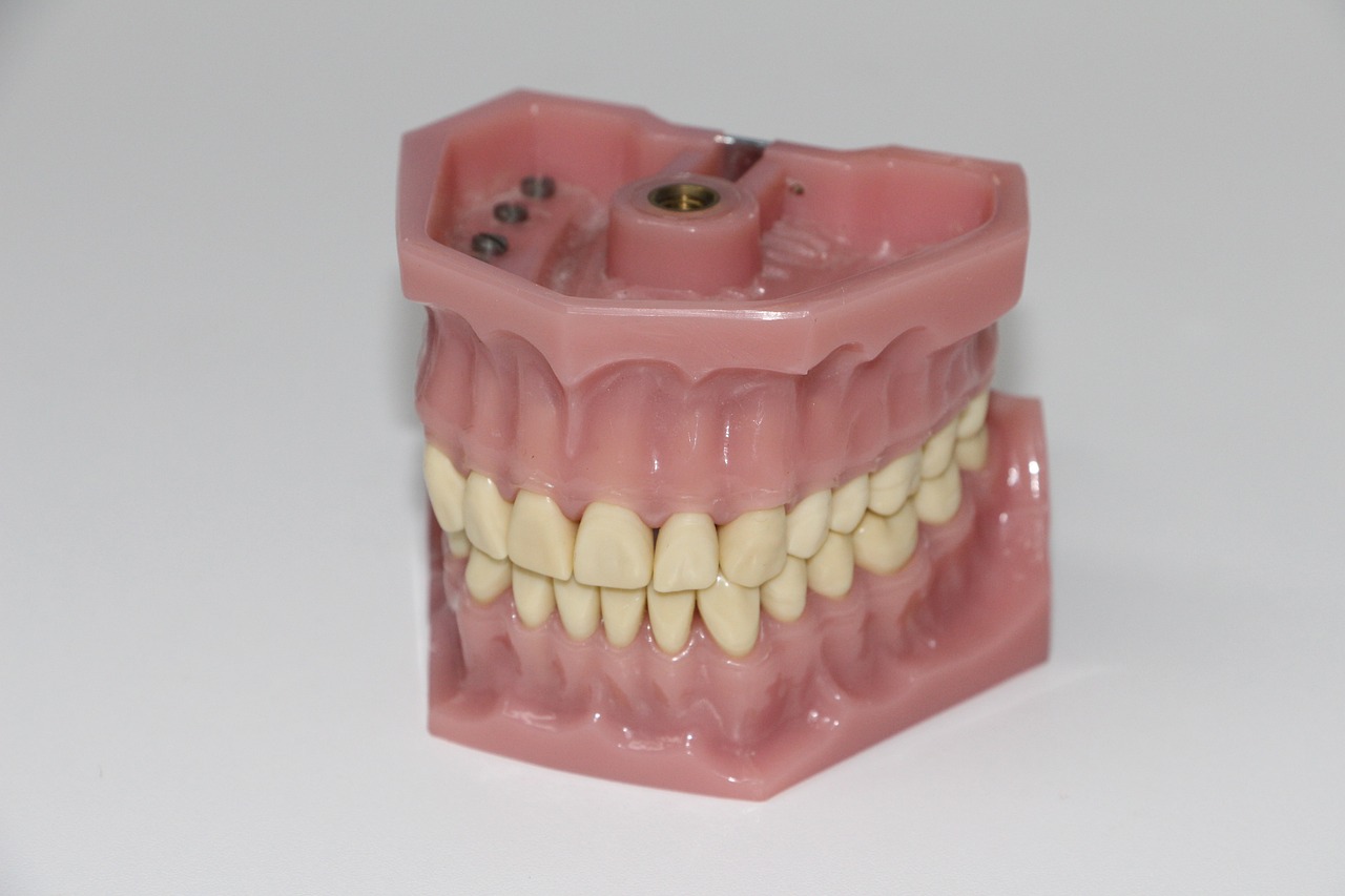 Prothèse dentaire provisoire