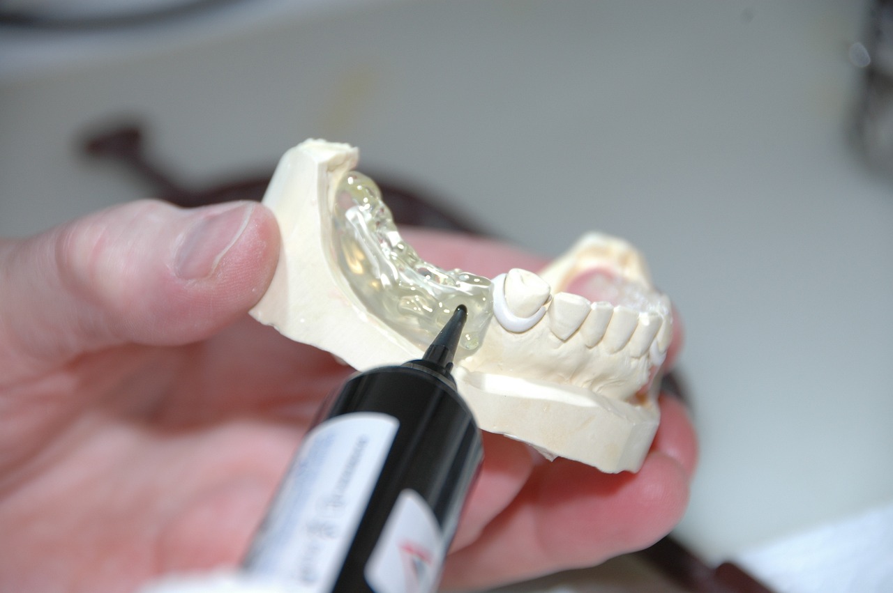 Prothèse dentaire provisoire