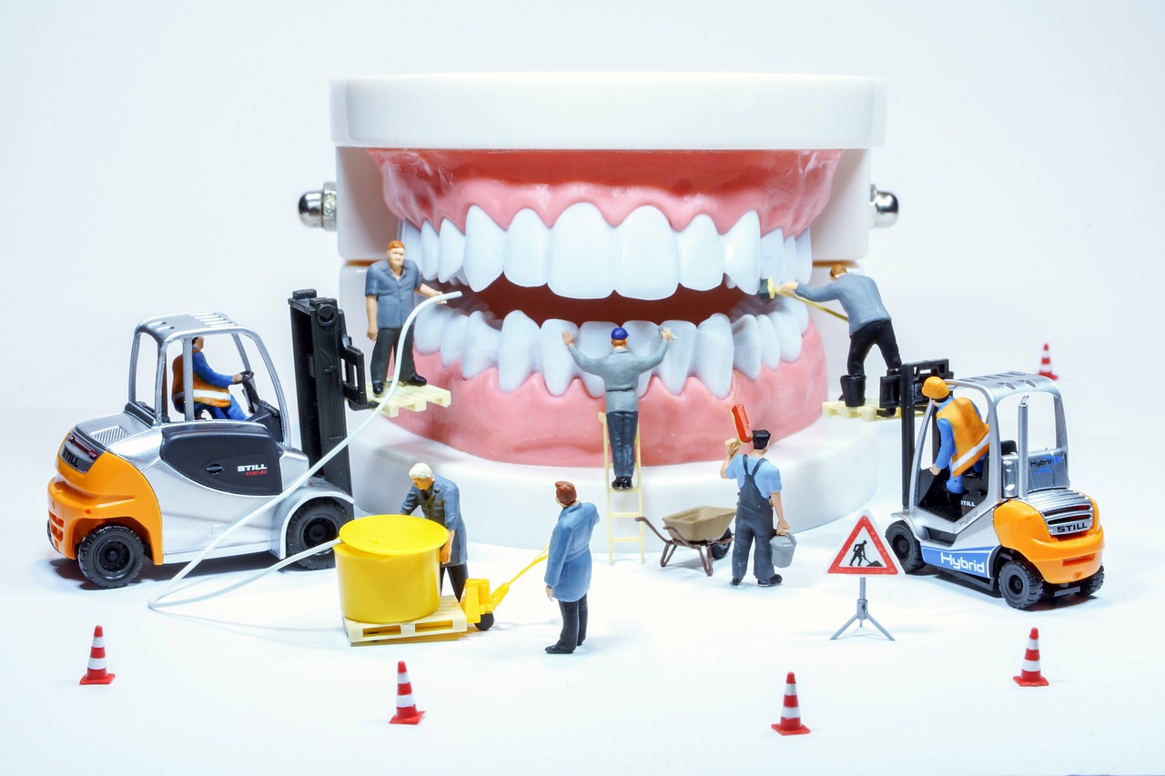 Implant dentaire en Hongrie