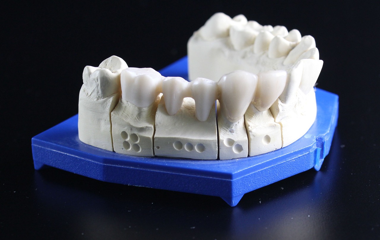 Les dents artificielles, laquelle utiliser et pourquoi ?