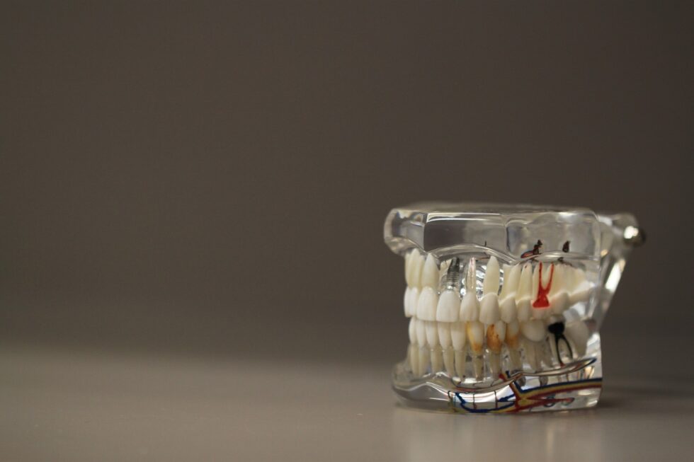 Couronne dentaire qui bouge causes, solutions et conseils