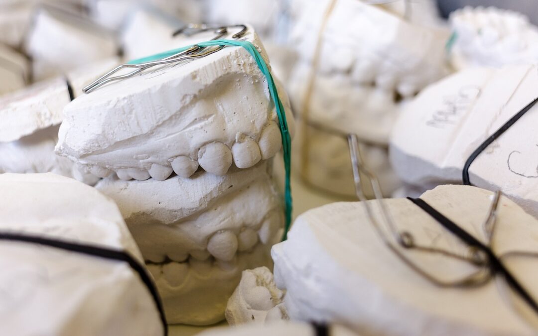 Couronne dentaire à Budapest : Tout savoir