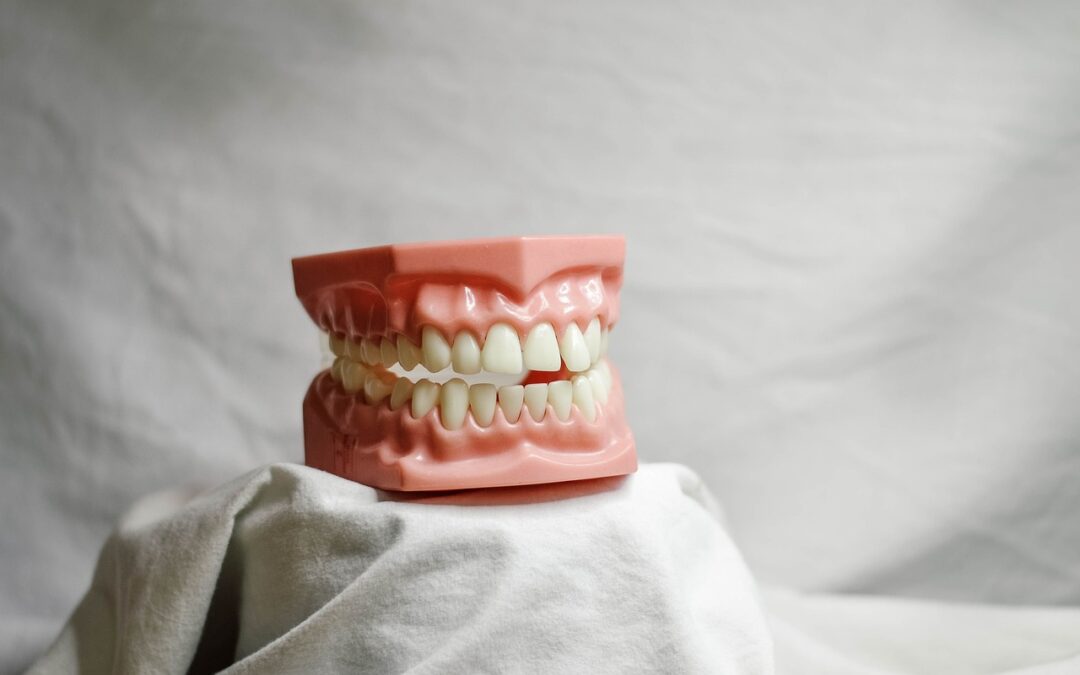 Couronne dentaire ou bridge dentaire : choix optimal