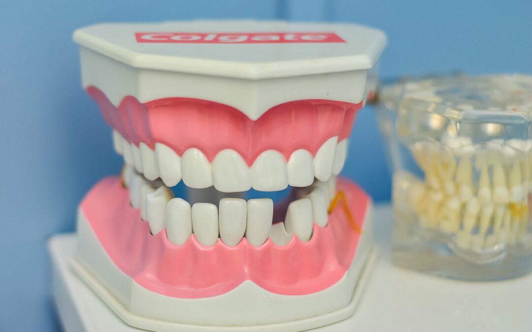 Réparer une dent cassée : solutions et prévention efficaces