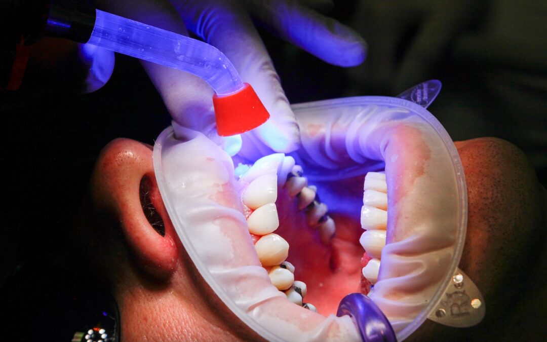 Sensibilité dentaire : comprendre et traiter la douleur