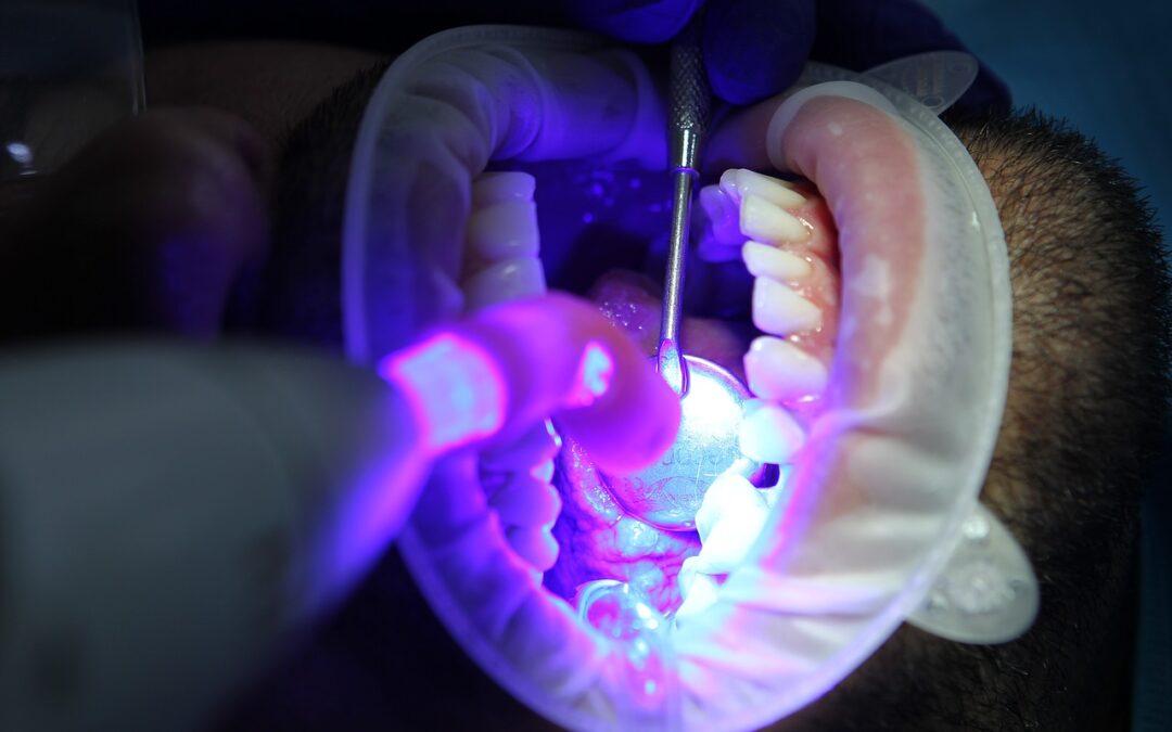 Choix difficile: bridge ou implant dentaire?