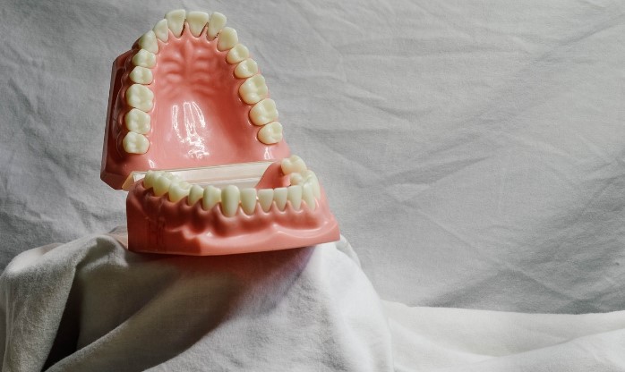 Tartre dentaire : guide complet pour retrouver des dents saines