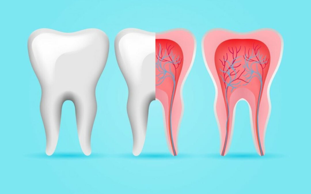 Douleur à la racine dentaire ? Guide complet + Solutions abordables en Hongrie