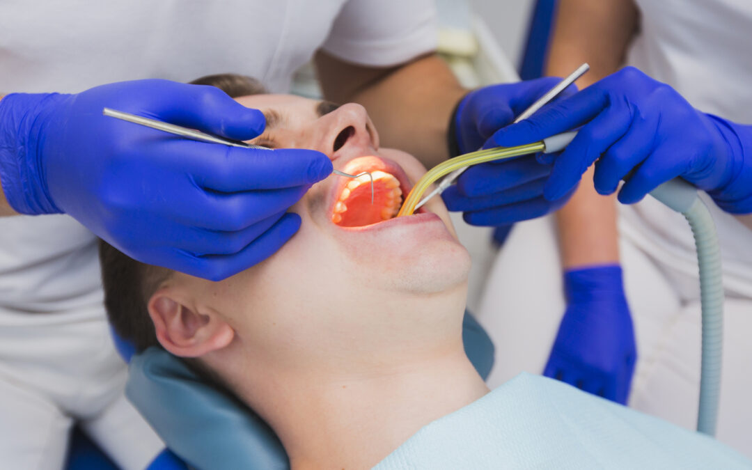 Avulsion dentaire Guide des solutions d'urgence et traitements en Hongrie