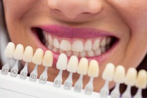 Émail dentaire usé que faire Guide Complet