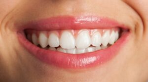 Gencives Blanches Guide Complet pour Diagnostic et Traitement