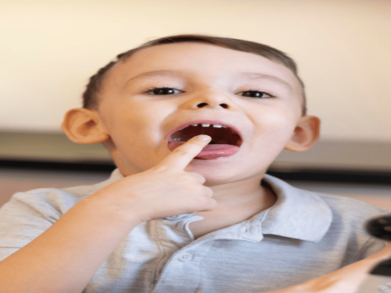 Dent de requin enfant que faire : Guide Complet des Solutions pour les Parents