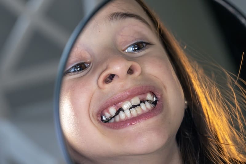 Dentine visible