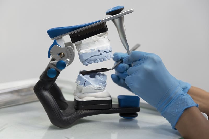 les différents types d'implants dentaires