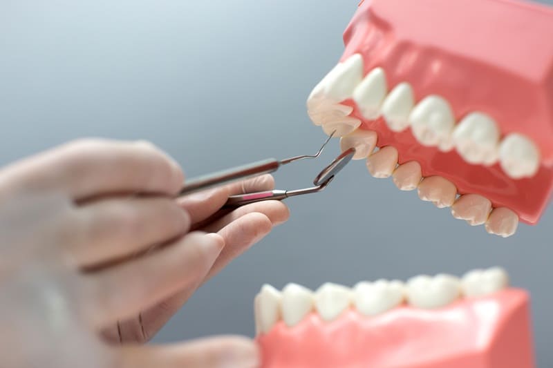 Quand poser un implant dentaire ? Le guide complet 2025