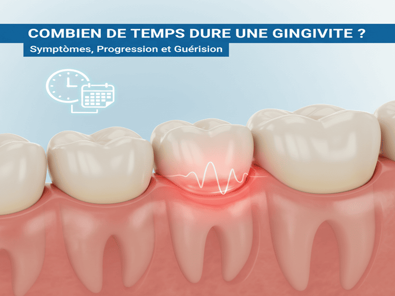 une gingivite